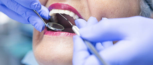Best Emergency Broken Tooth Repair in Somersworth, NH